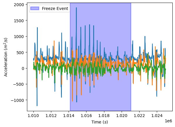 Comparison of ML Techniques for Freezing of Gait Detection